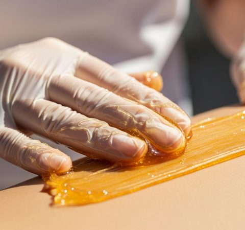A person hand, wearing gloves, is applying a warm, amber colored wax, light skin surface for a hair removal treatment