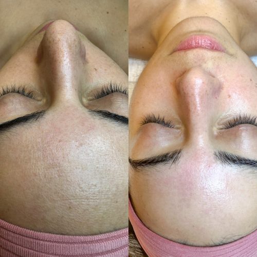 Lily Beauty Space - London Bespoke Facials and waxing (12)