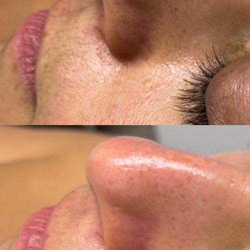 Lily Beauty Space - London Bespoke Facials and waxing (3)